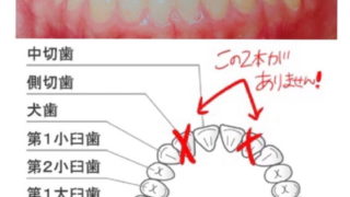 歯と歯並びの図