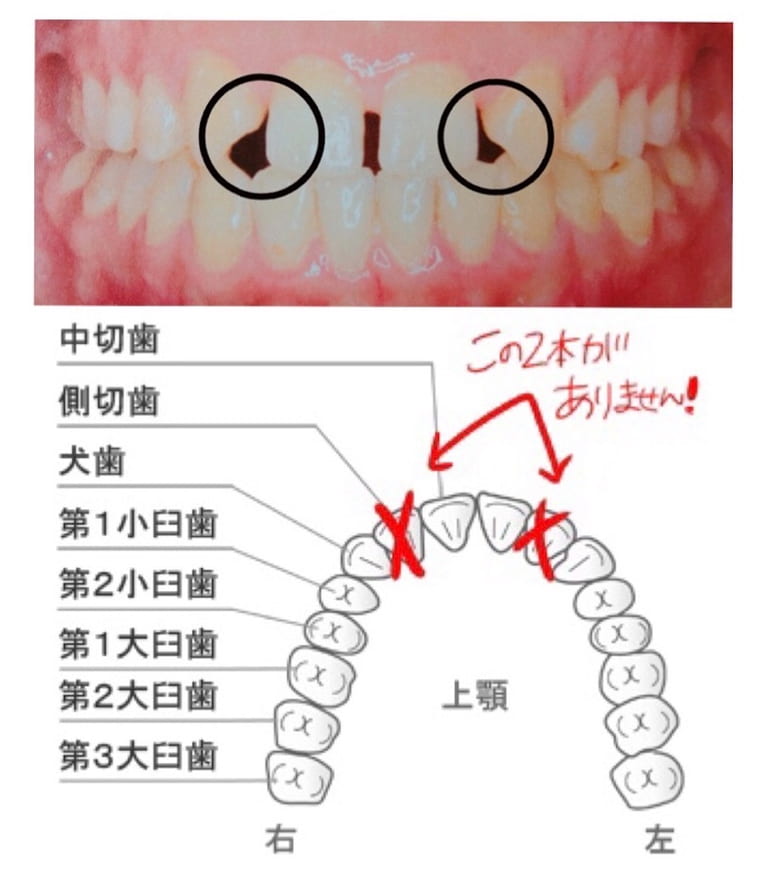歯と歯並びの図